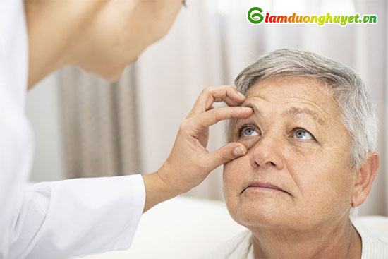 Người bệnh nên khám mắt 6 tháng một lần để phát hiện sớm biến chứng tiểu đường ở mắt