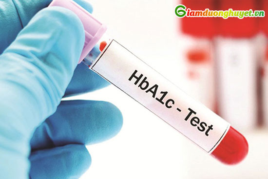 Kiểm tra HbA1C ít nhất 3 tháng/ lần đánh giá tình trạng kiểm soát đường huyết